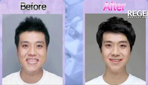 before-after_care